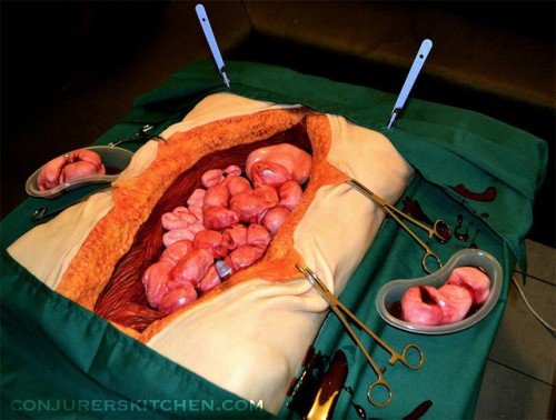 Surgery-Cake